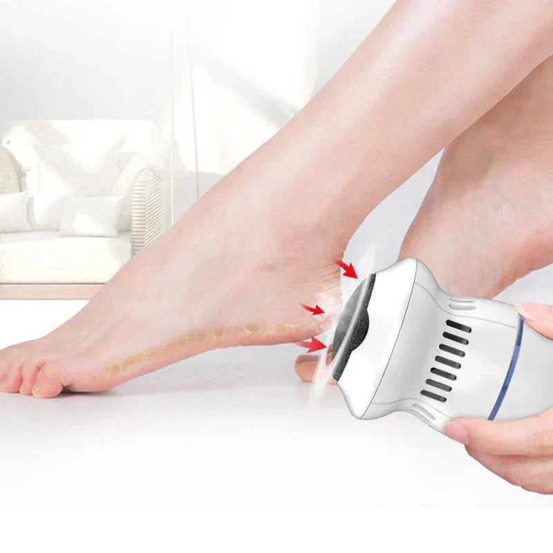 Electric Callus Remover | USB Rechargeable Foot File Vacuum